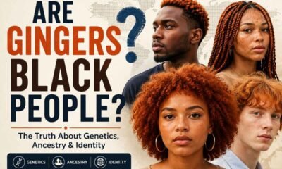 Are Gingers Black People